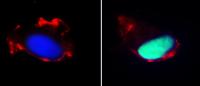 comparison between vascular cell from person who got adequate sleep vs vascular cells from person who got poor sleep